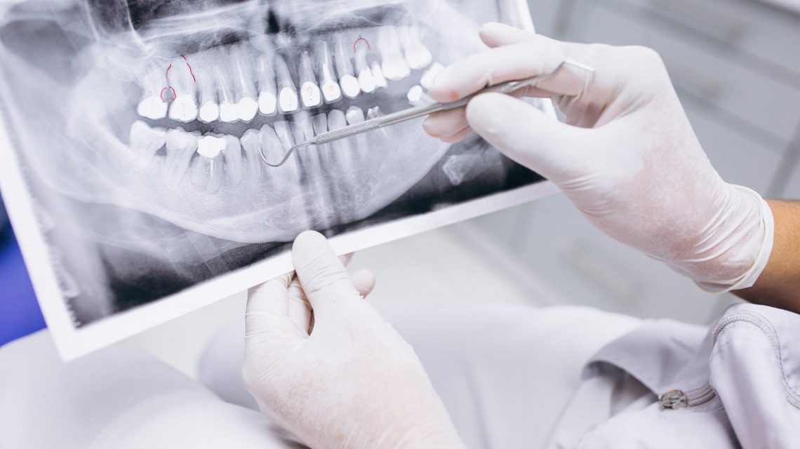 La importancia de un diágnostico dental correcto